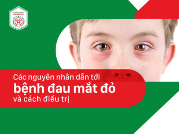 TUYÊN TRUYỀN PHÒNG CHỐNG BỆNH ĐAU MẮT ĐỎ