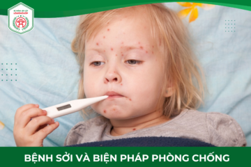 TUYÊN TRUYỀN PHÒNG CHỐNG BỆNH SỞI