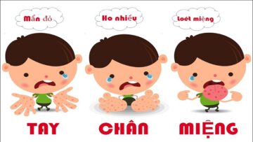 TUYÊN TRUYỀN  PHÒNG CHỐNG BỆNH TAY CHÂN MIỆNG