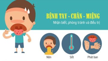 BÀI TUYÊN TRUYỀN PHÒNG BỆNH TAY CHÂN MIỆNG
